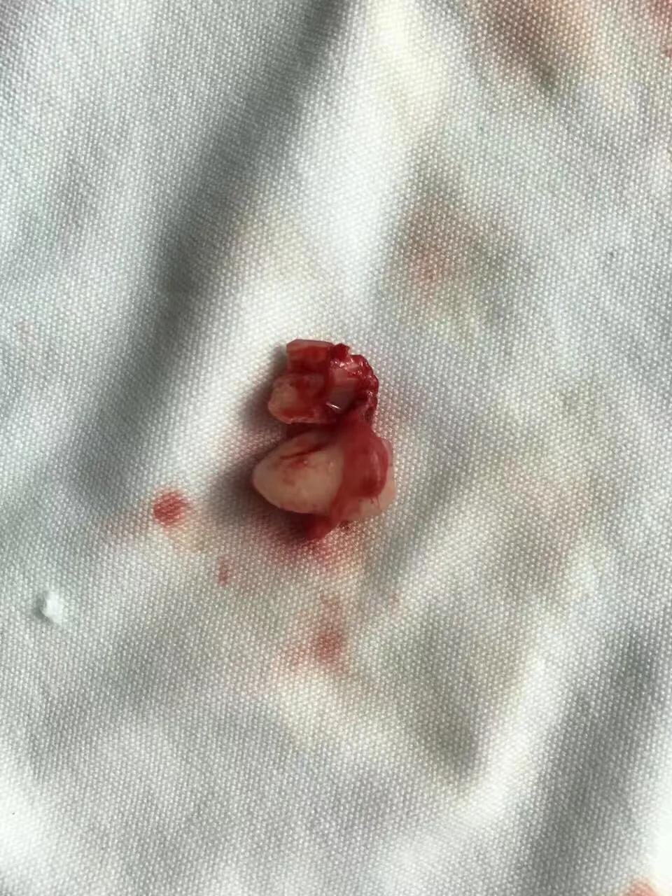 口腔垃圾怎么处理,口腔护理中的垃圾怎么分类处理