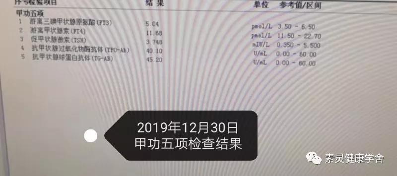 肝功异常的针灸穴位,脐疗绝密配方肝病