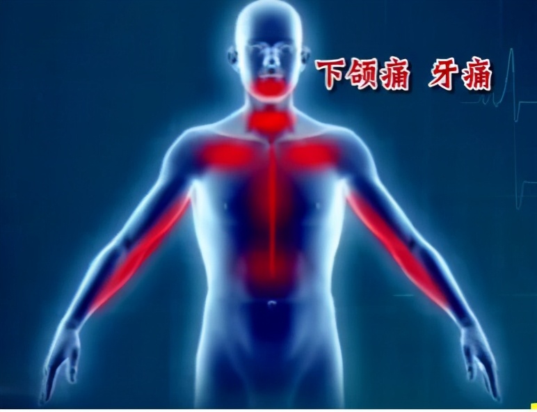 没有征兆而突发心梗有多可怕,哪些地方疼会是心梗的前兆