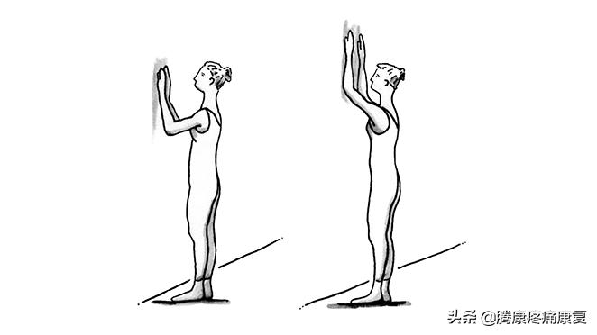 肩关节急性钙化性肌腱炎