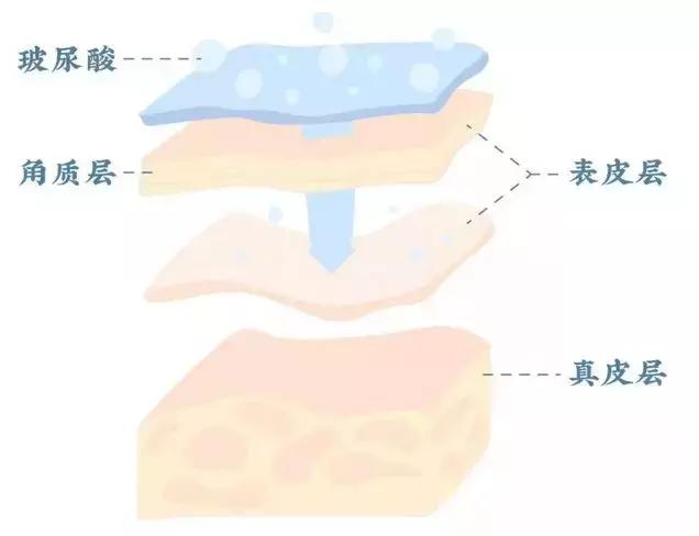 玻尿酸护肤品真的好用吗,玻尿酸的护肤功效及使用方法
