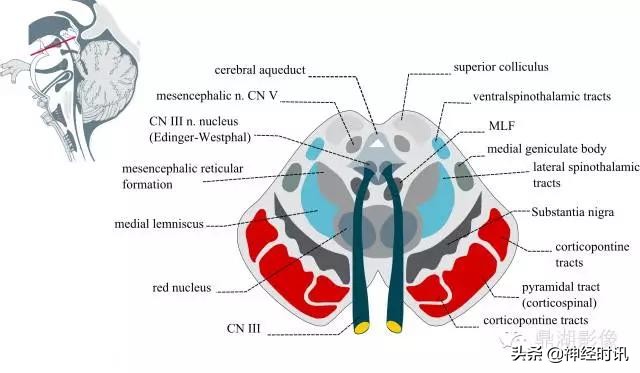 基底节ct解剖示意图,影像解剖图谱怎么用