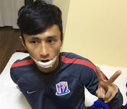 申花记忆:请记住那些为申花“受伤”的球员,我们向他们致敬……