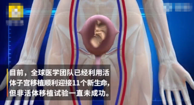 无子宫生娃,无子宫可以做试管生孩子吗