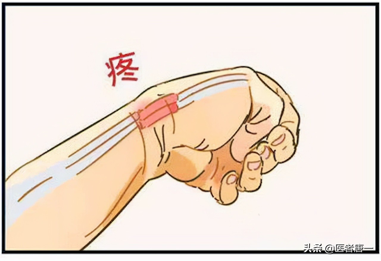 50多岁女性手指腱鞘炎怎么治,59岁女性容易发腱鞘炎应注意什么