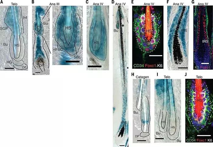 秃头有治愈的曙光吗,秃头有救了医生开的药