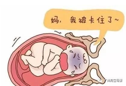 屁股大的女生好生养,屁股大的女人适合生孩子吗