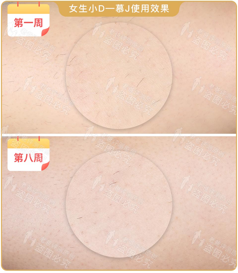 最真实的脱毛仪,bequeen脱毛仪实测