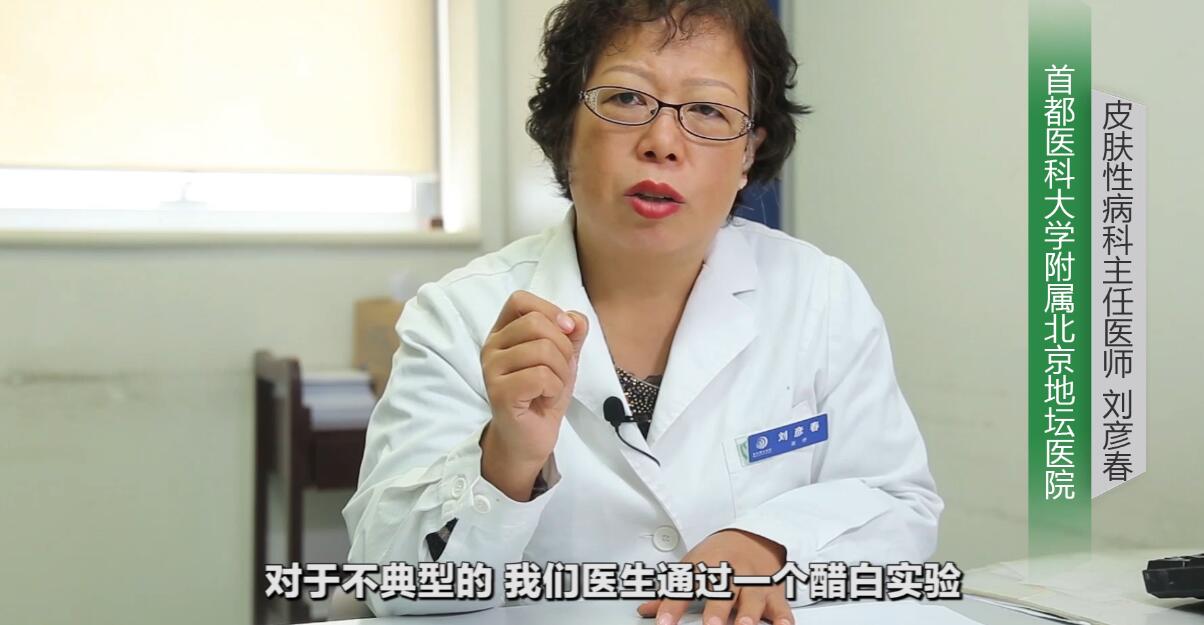 尖锐性湿疣检查查哪些项目,尖锐性湿疣需要检查什么项目