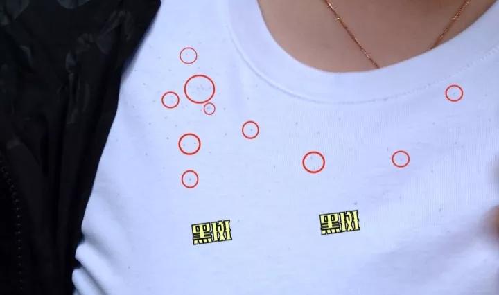 衣服上的小黑点怎么去,衣服出现小黑点怎么办