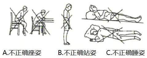 腰椎间盘突出正确锻炼方法,热敷对腰椎间盘突出有用吗