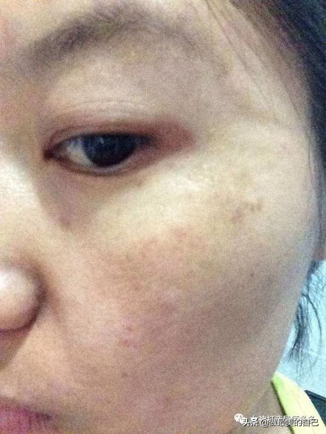 斑点暗黄肌最全的改善小技巧，都在这里