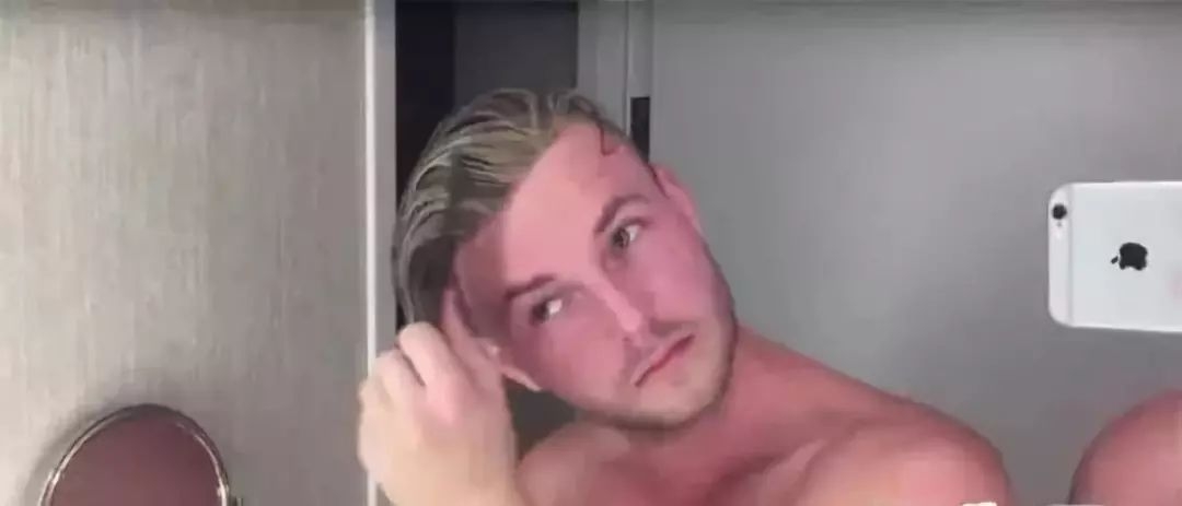 90后没有发际线,90后00后如何不脱发