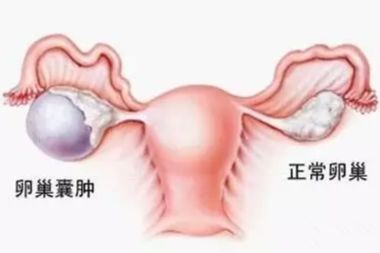 疫情期间特殊病种的人怎么办,疫情期间特殊感染怎么办