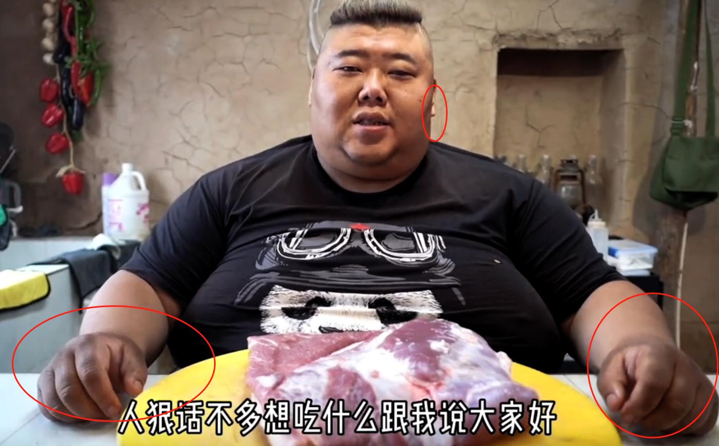 胖猴仔满脸黑斑,胖猴仔身体发黑