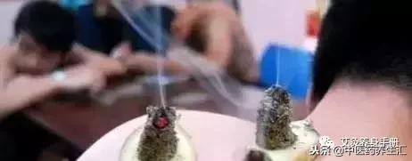 艾灸新手要注意的八个穴位,新手艾灸实用教程从零开始学艾灸