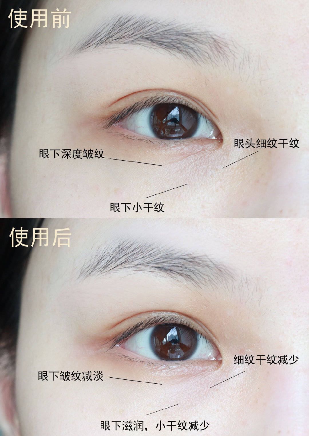 什么品牌眼霜有玻色因六胜肽,视黄醇玻色因冻龄眼霜