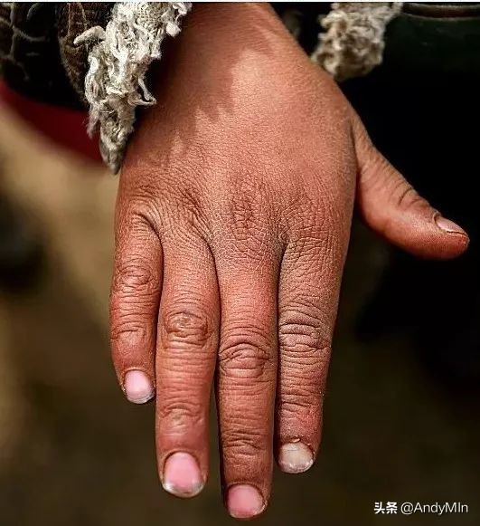 挖10万元1斤的虫草,却买不起一个玩具|高原孩子的残酷童年