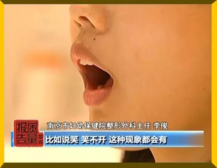 花了26万做整容手术,24岁女子花21万整容