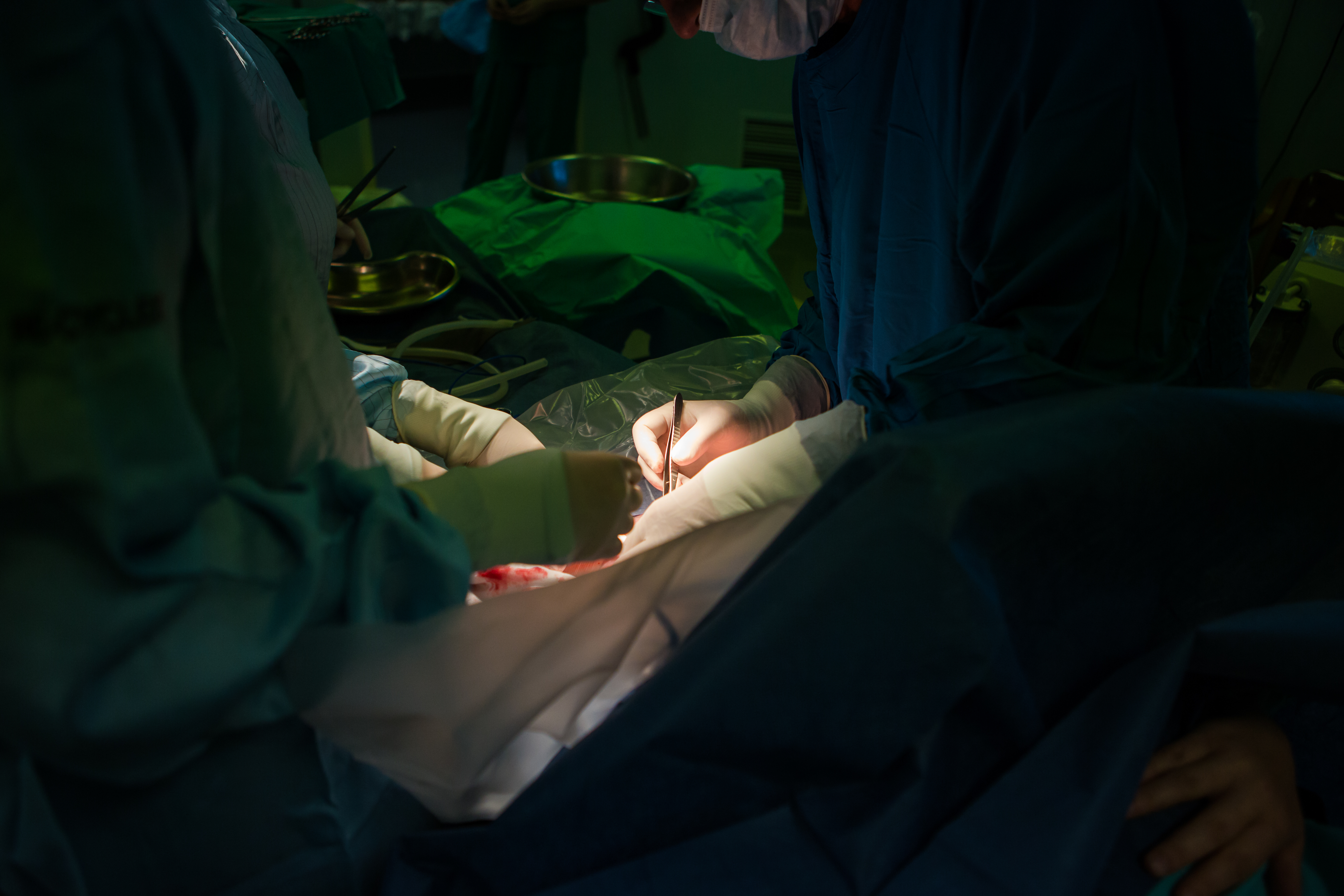 孩子11岁学不会骑自行车,走路易摔跤,剖宫产造成了感统失调?