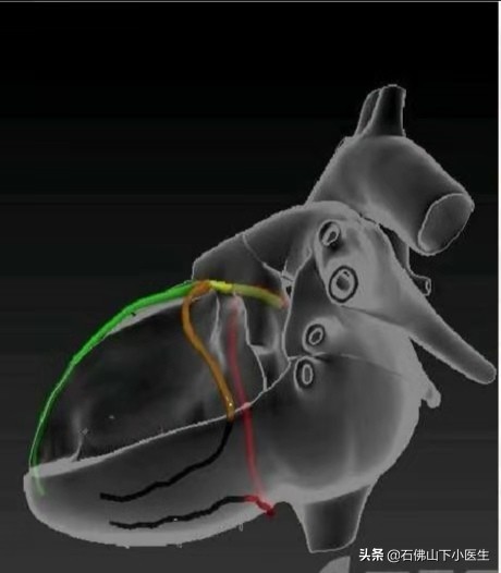 跟陈大夫学看冠脉，看一下人体的冠脉是怎么样的