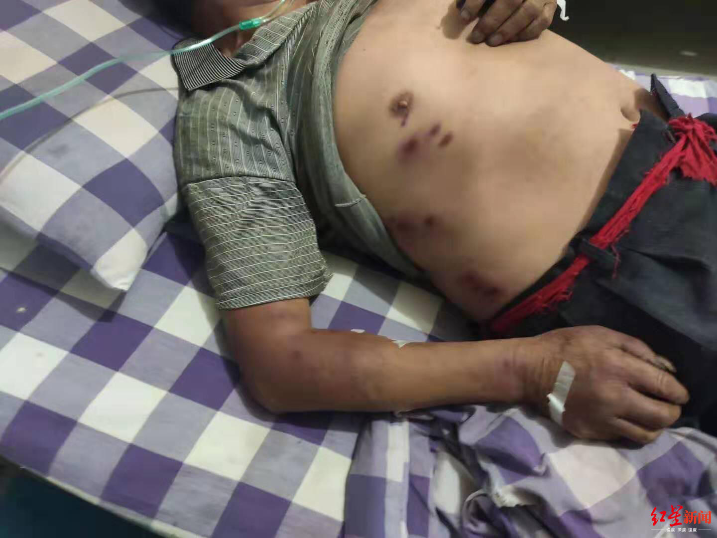 被胡蜂蜇死的养蜂人,野蜂蜂巢被摘无家可归发狂蜇死人