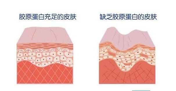 产后祛斑护肤品什么牌子好,生完宝宝脸上的斑怎样才可以消除