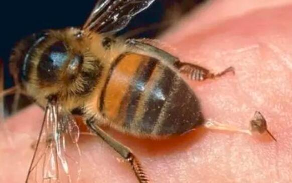 被蜜蜂蛰了该咋办怎么处理,被蜜蜂蛰了应该怎么应急处理