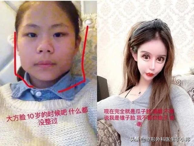 整容成功逆袭的女人,整容整形成功逆袭案例