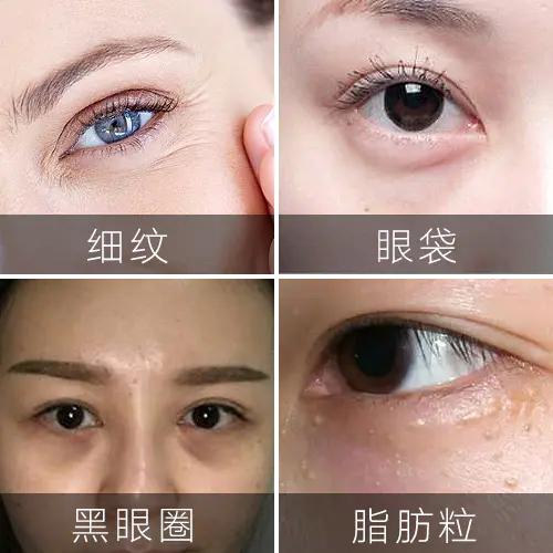 能放进包包的“美容院”,随时淡纹护眼,素颜美女少不了它