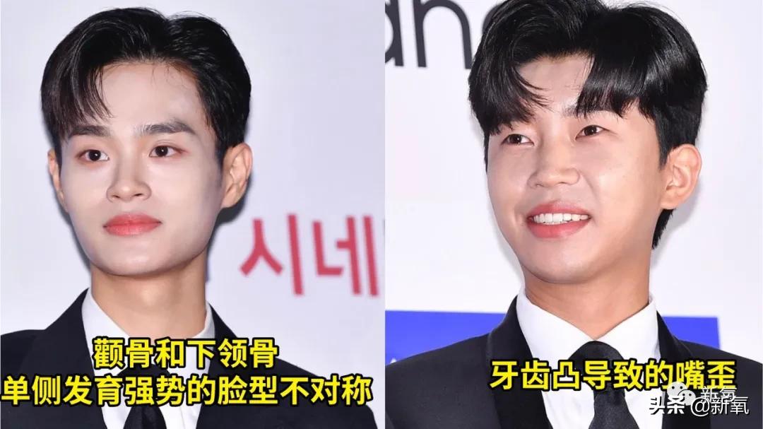 大小脸不对称怎么改变,大小脸不对称改善动作