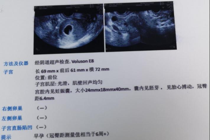 你知道人流方面的常识吗,人流要用平常心对待