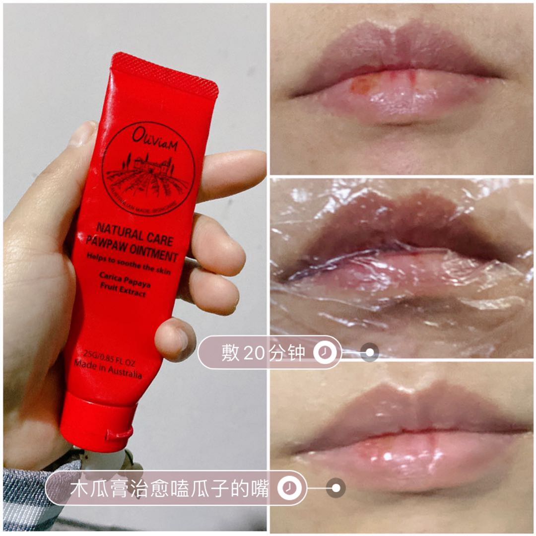 澳洲木瓜膏可以祛痘么,澳洲木瓜膏真的可以祛痘痘吗