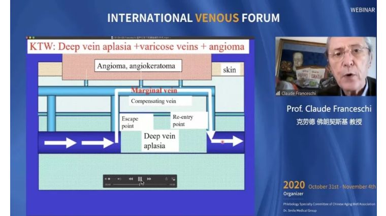 开幕第一天精彩回顾｜2020国际静脉病论坛持续进行中