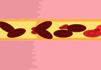 警惕这种病进入高发专家紧急提醒,这些病一定要重视起来别不当回事