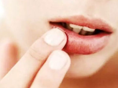 唇癌治疗偏方,唇癌哪个医院治疗好