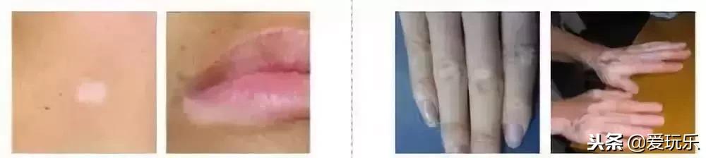 孩子玩水彩笔的危害,用水彩笔画画适合儿童的话