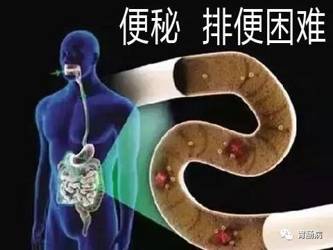 便秘不是小事,便秘不是大问题不需要太过紧张