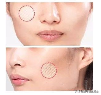 让颧骨变小的按摩手法,按摩能使脸变小嘛