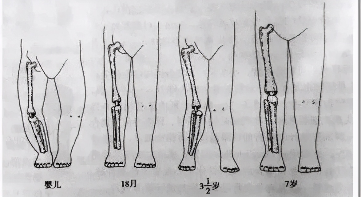 如何让宝宝拥有笔直的大长腿？首先别掉进扶贫这个坑里