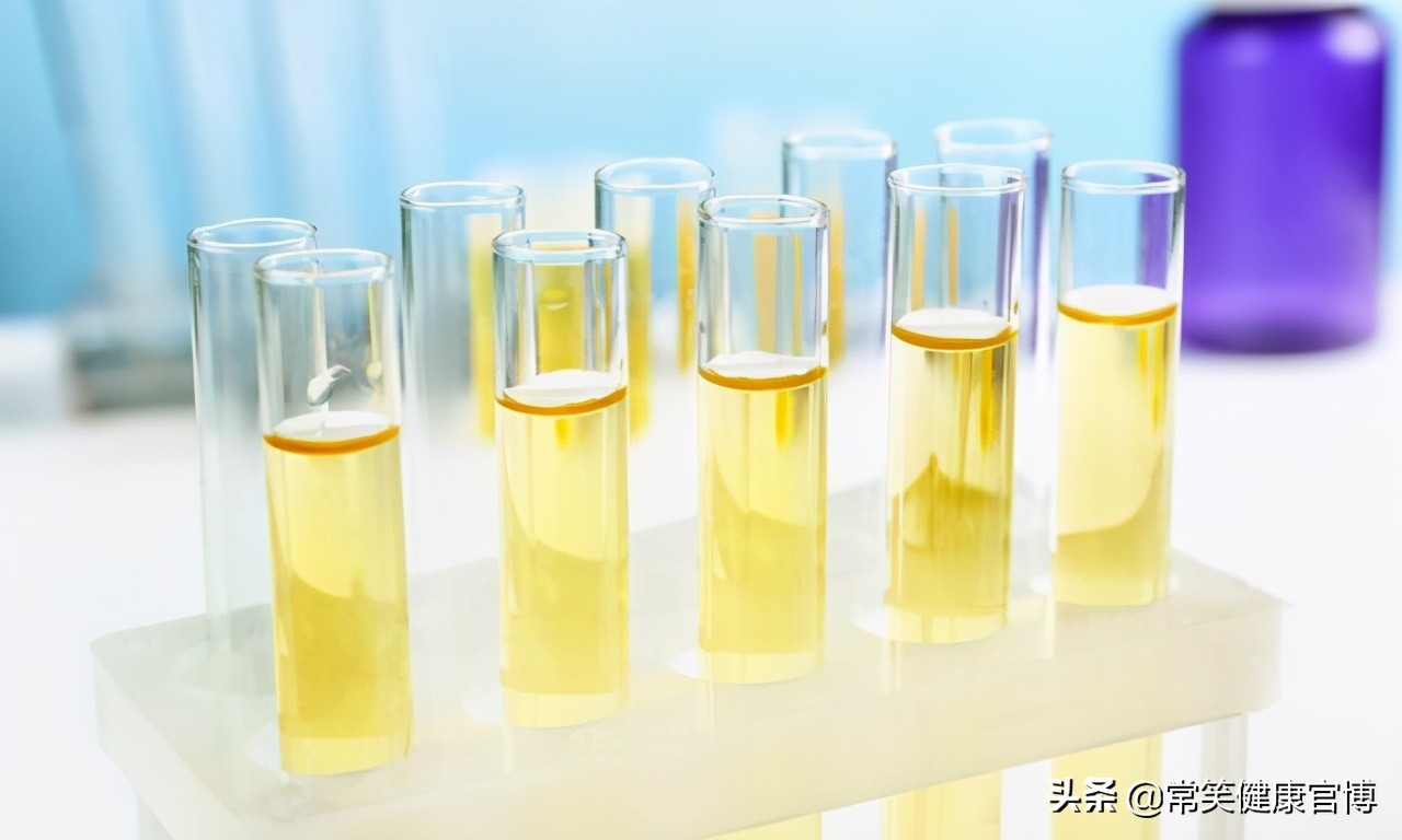 尿液淡黄色和深黄色的对比,尿液黄色和淡黄色的区别