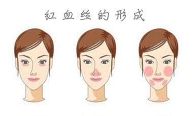 拿什么拯救我的高原红,拯救高原红