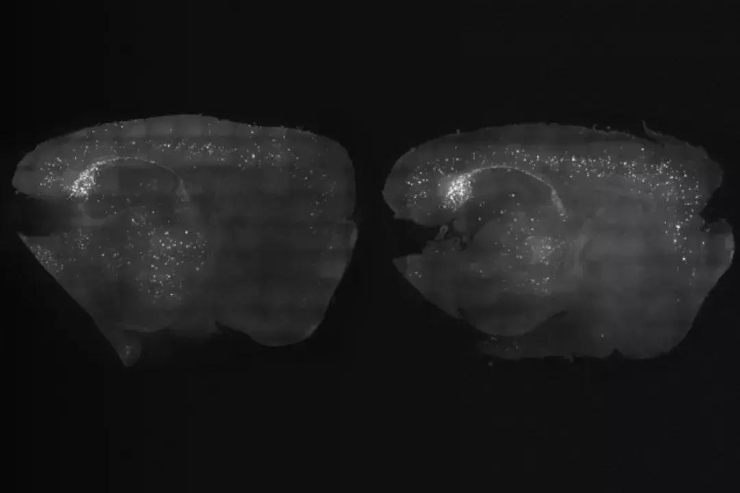 40赫兹预防老年痴呆音乐,新发现有望治疗阿尔茨海默病
