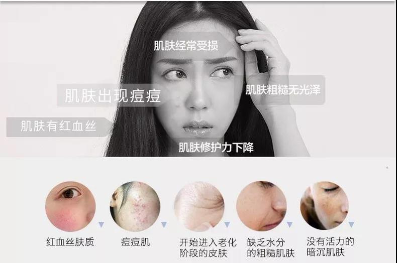 换季起皮水乳推荐,换季脸干起皮水乳推荐