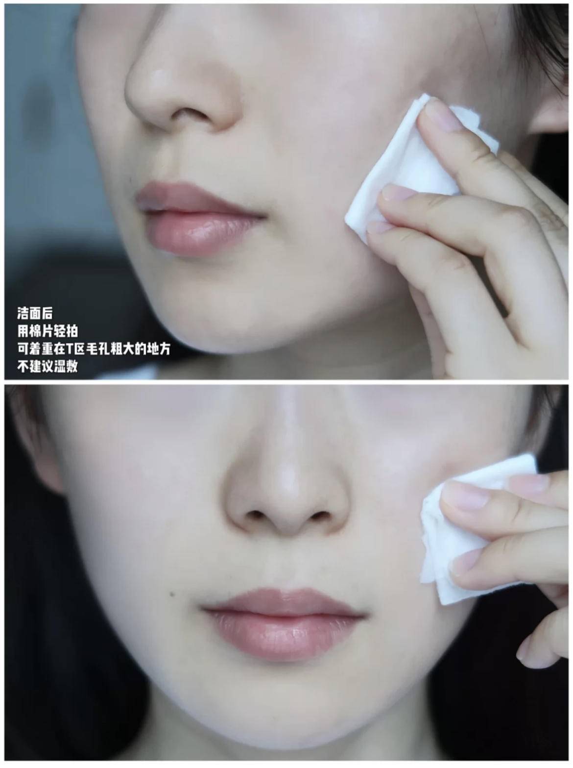 脸上有个光滑不痛不痒的小疙瘩,脸上皮肤粗糙长疙瘩是怎么回事