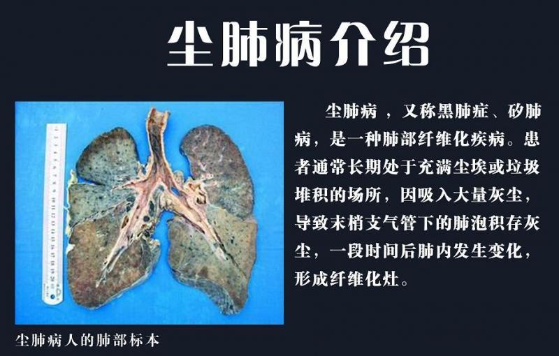电焊这个工作危险吗,电焊工会有危害吗