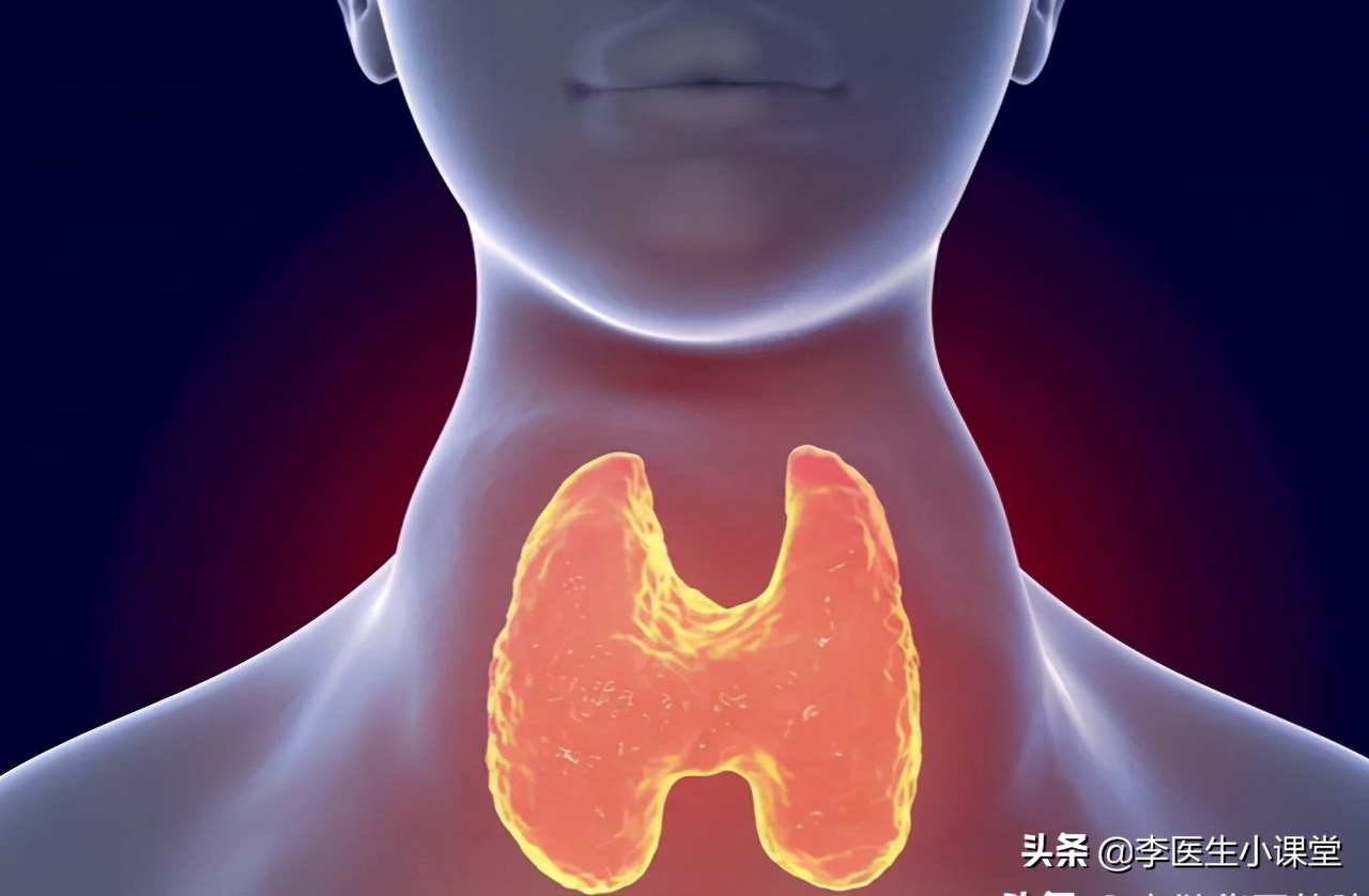 桥本氏甲状腺炎会引发ca125升高吗,桥本氏甲状腺炎能自愈或治愈吗