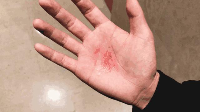 明星牙齿矫正前后对比,明星牙齿矫正都用的什么矫正方式