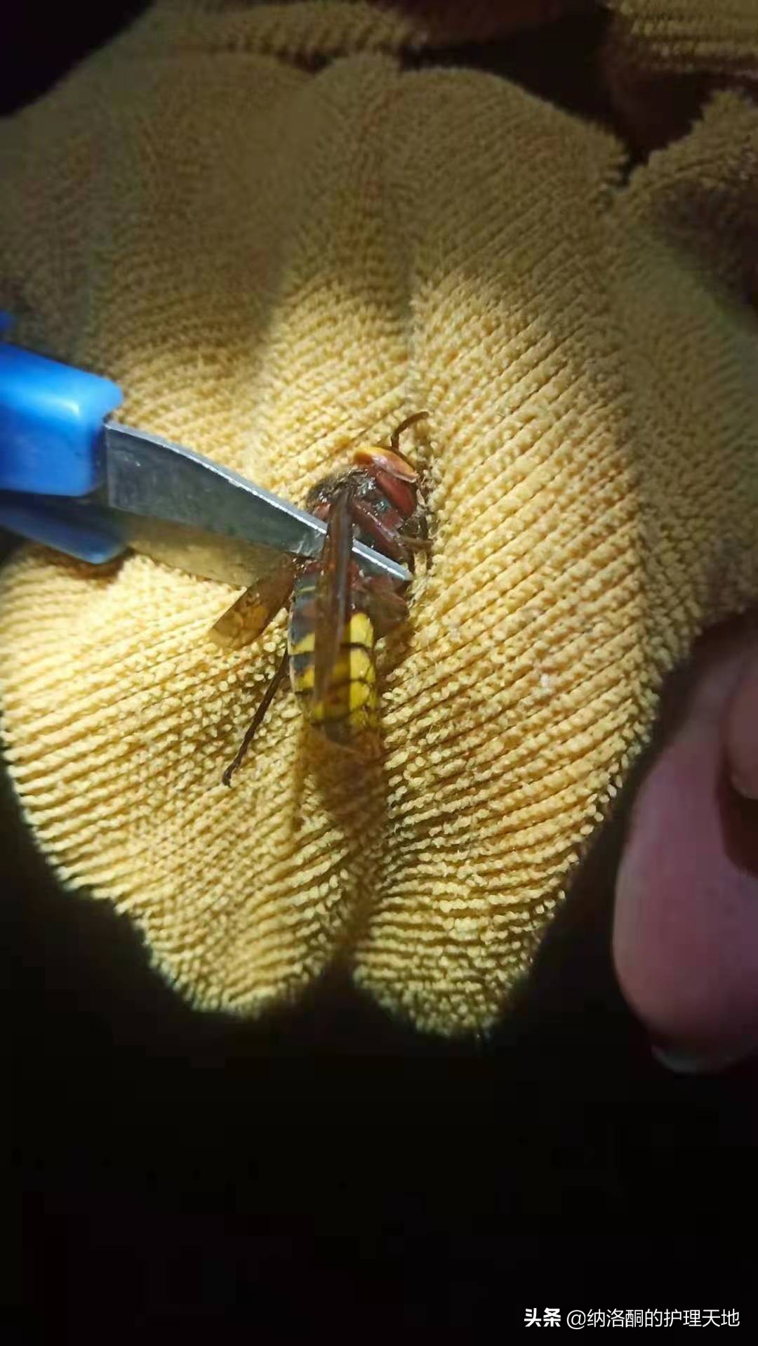 被金环胡蜂咬了肿了在家怎么办,被金环虎头蜂蛰了如何止疼