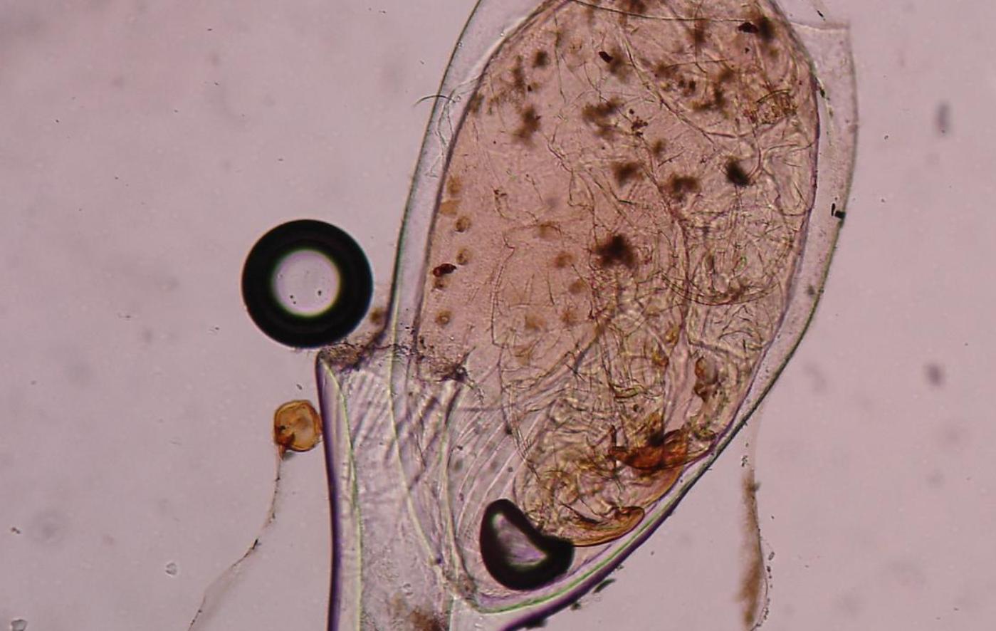 30年前每个人身上都有虱子,30年前人人都有的虱子为什么不见